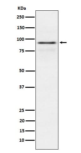 Anti-RSK1 p90 Rabbit Monoclonal Antibody Boster Bio