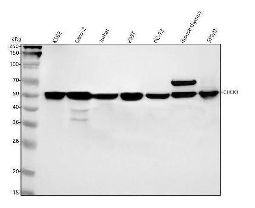 Anti-Chk1 CHEK1 Rabbit Monoclonal Antibody Boster Bio