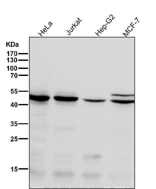 Anti-Chk1 CHEK1 Rabbit Monoclonal Antibody Boster Bio