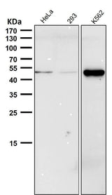 Anti-Phospho-Chk1 (S280) Rabbit Monoclonal Antibody Boster Bio