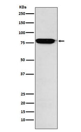 Anti-RANK Rabbit Monoclonal Antibody Boster Bio