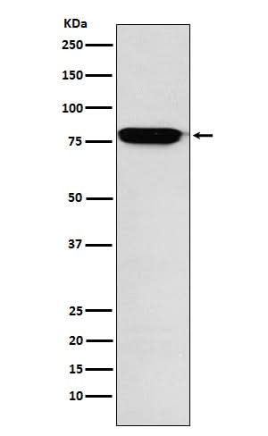 Anti-RANK Rabbit Monoclonal Antibody Boster Bio