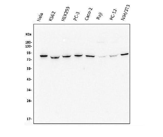Anti-Methylmalonyl Coenzyme A mutase Antibody Picoband® (monoclonal, 2D6 Boster Bio