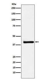 Anti-XRCC3 Rabbit Monoclonal Antibody Boster Bio