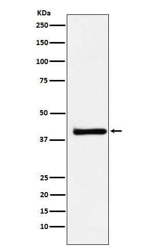 Anti-XRCC3 Rabbit Monoclonal Antibody Boster Bio