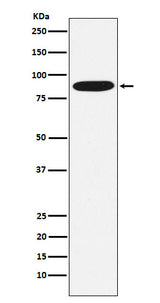 Anti-MST1 Rabbit Monoclonal Antibody Boster Bio