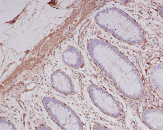 Anti-alpha smooth muscle Actin ACTA2 Rabbit Monoclonal Antibody Boster Bio