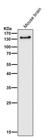 Anti-PER2 Rabbit Monoclonal Antibody Boster Bio