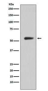 Anti-CA9/Ca Ix Rabbit Monoclonal Antibody Boster Bio