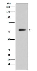 Anti-CA9/Ca Ix Rabbit Monoclonal Antibody Boster Bio