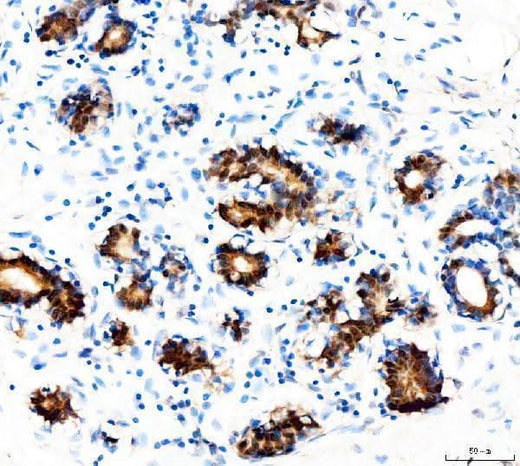 Anti-STAT5a Rabbit Monoclonal Antibody Boster Bio