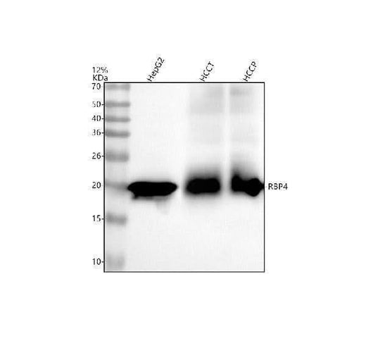 Anti-RBP4 Monoclonal Antibody Boster Bio