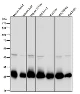 Anti-SDHB Rabbit Monoclonal Antibody Boster Bio