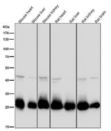 Anti-SDHB Rabbit Monoclonal Antibody Boster Bio