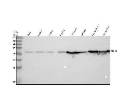Anti-SDHB Rabbit Monoclonal Antibody Boster Bio