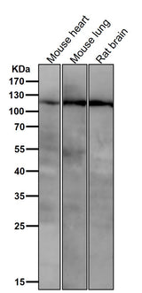 Anti-PI3 Kinase p110 beta Rabbit Monoclonal Antibody Boster Bio