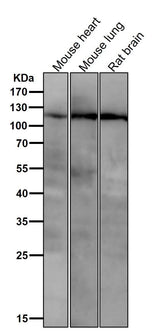 Anti-PI3 Kinase p110 beta Rabbit Monoclonal Antibody Boster Bio
