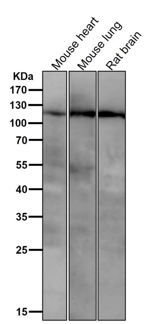 Anti-PI3 Kinase p110 beta Rabbit Monoclonal Antibody Boster Bio