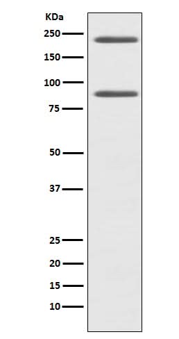 Anti-C4 Rabbit Monoclonal Antibody Boster Bio