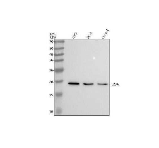 Anti-IL23 Rabbit Monoclonal Antibody Boster Bio