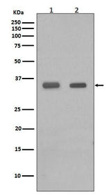 Anti-CEBP Beta Rabbit Monoclonal Antibody Boster Bio
