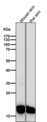 Anti-CEBP beta Rabbit Monoclonal Antibody Boster Bio