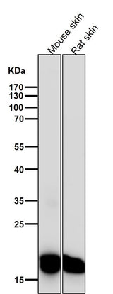 Anti-CEBP beta Rabbit Monoclonal Antibody Boster Bio