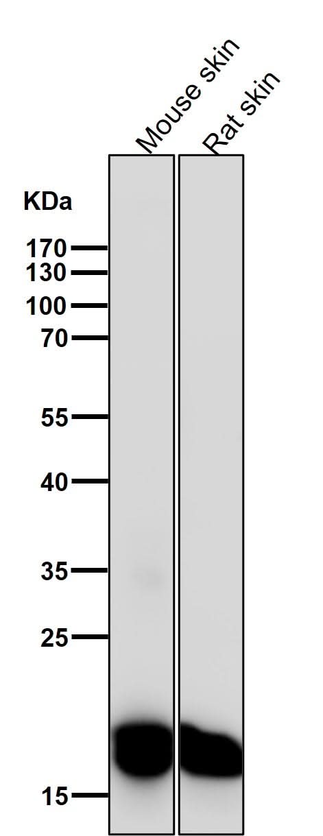 Anti-CEBP beta Rabbit Monoclonal Antibody Boster Bio