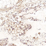 Anti-CD41 ITGA2B Rabbit Monoclonal Antibody Boster Bio