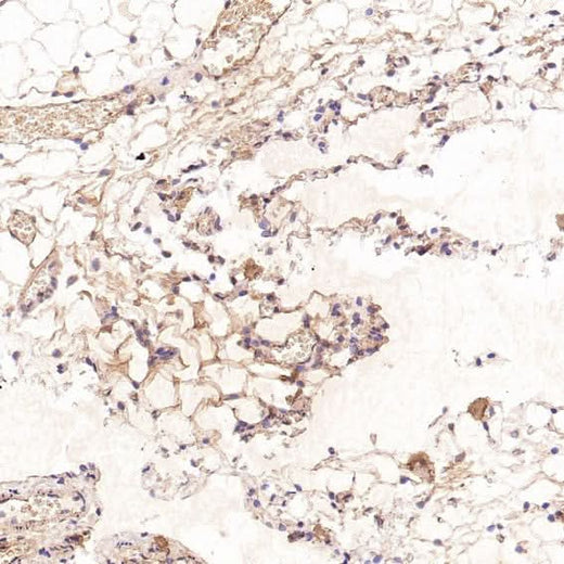 Anti-CD41 ITGA2B Rabbit Monoclonal Antibody Boster Bio