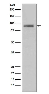Anti-Hsp90 alpha HSP90AA1 Rabbit Monoclonal Antibody Boster Bio