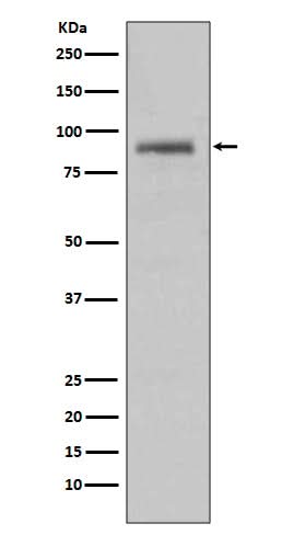 Anti-Hsp90 alpha HSP90AA1 Rabbit Monoclonal Antibody Boster Bio