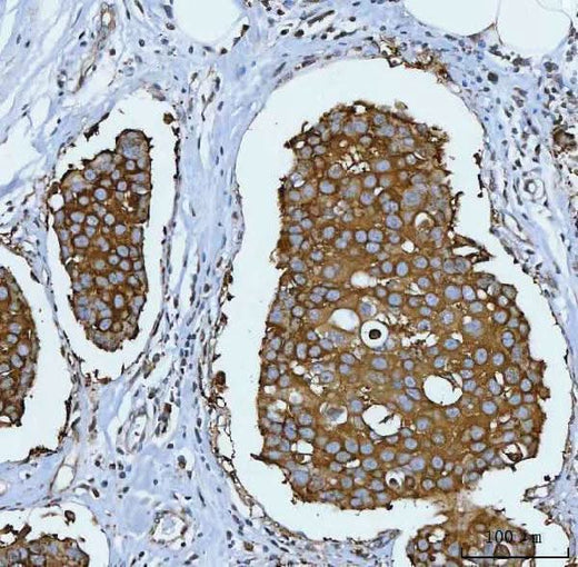 Anti-Hsp90 alpha + beta HSP90AA1 Rabbit Monoclonal Antibody Boster Bio