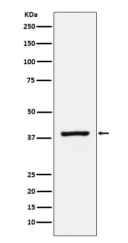 Anti-RASSF1 Rabbit Monoclonal Antibody Boster Bio