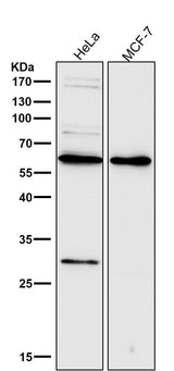 Anti-PDCD4 Rabbit Monoclonal Antibody Boster Bio