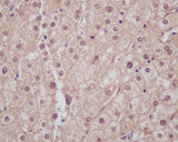 Anti-Liver Arginase ARG1 Rabbit Monoclonal Antibody Boster Bio