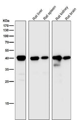 Anti-CD40L CD40LG Rabbit Monoclonal Antibody Boster Bio