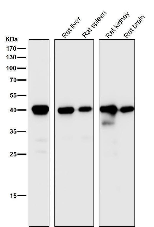 Anti-CD40L CD40LG Rabbit Monoclonal Antibody Boster Bio