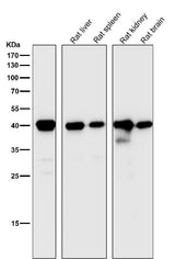 Anti-CD40L CD40LG Rabbit Monoclonal Antibody Boster Bio