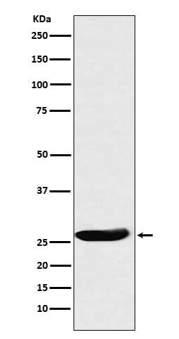 Anti-CLPP Rabbit Monoclonal Antibody Boster Bio