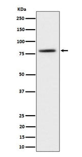 Anti-TORC2 Rabbit Monoclonal Antibody Boster Bio