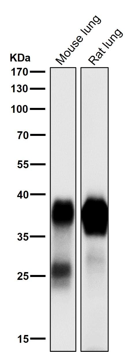 Anti-Podoplanin PDPN Rabbit Monoclonal Antibody Boster Bio