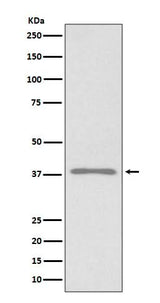 Anti-Podoplanin PDPN Rabbit Monoclonal Antibody Boster Bio