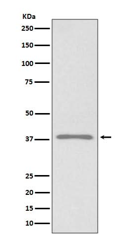 Anti-Podoplanin PDPN Rabbit Monoclonal Antibody Boster Bio