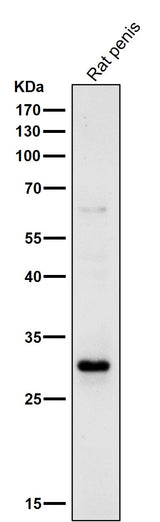 Anti-14-3-3 sigma SFN Rabbit Monoclonal Antibody Boster Bio