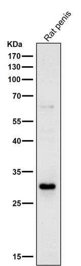 Anti-14-3-3 sigma SFN Rabbit Monoclonal Antibody Boster Bio