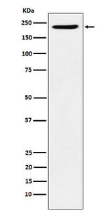 Anti-PBRM1 Rabbit Monoclonal Antibody Boster Bio
