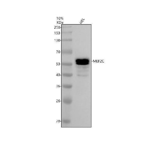 Anti-MEF2C Rabbit Monoclonal Antibody Boster Bio