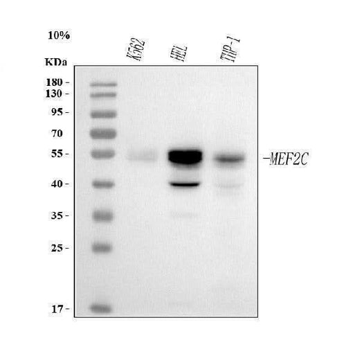 Anti-MEF2A+MEF2C Rabbit Monoclonal Antibody Boster Bio