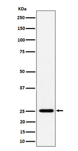 Anti-CFD Rabbit Monoclonal Antibody Boster Bio